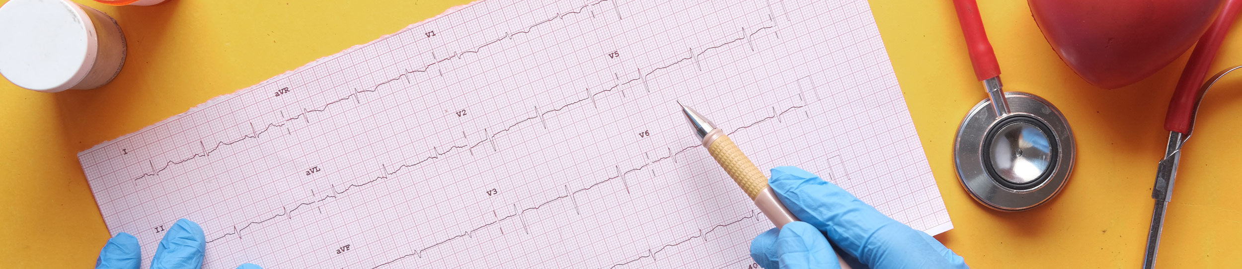 7Springs Medical Practice ECGs